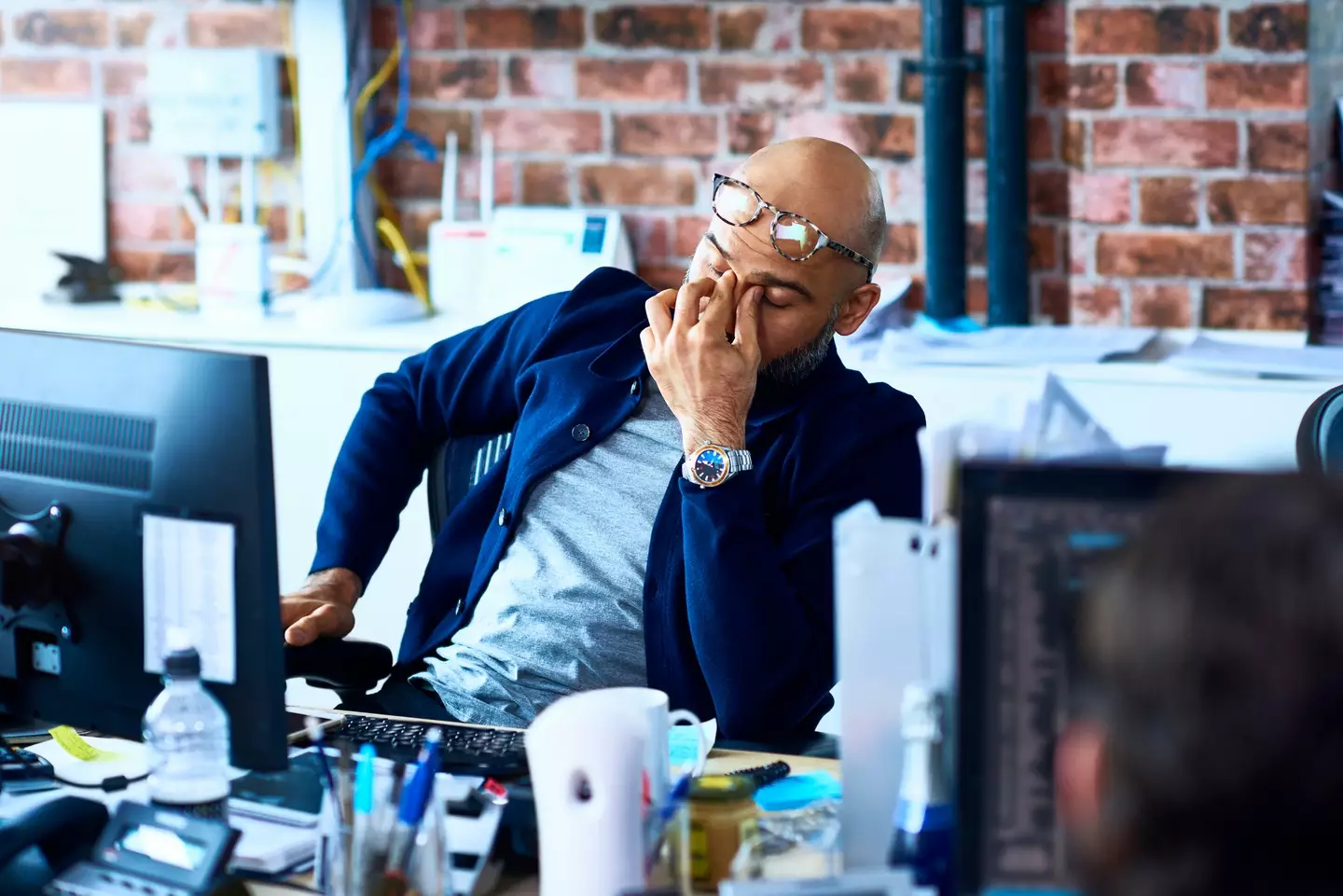 A busy schedule can lead to dark circles (Getty Stock Photo)